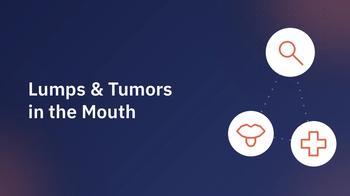 Mouth Tumor Symptoms: Benign vs. Malignant Warning Signs